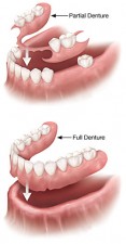 Bahamas Dentistry Dentures